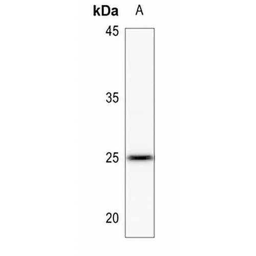 LYPLA1 Rabbit Polyclonal Antibody