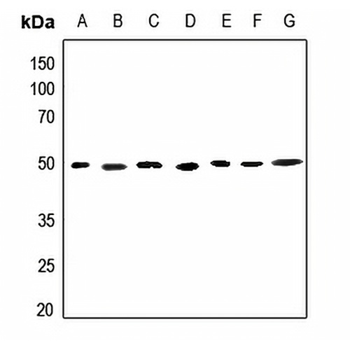ACOT2 Rabbit Polyclonal Antibody