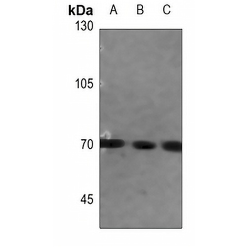 FATP5 Rabbit Polyclonal Antibody