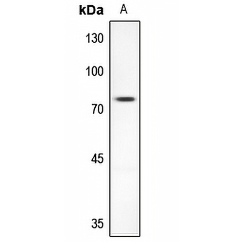 AKAP10 Rabbit Polyclonal Antibody