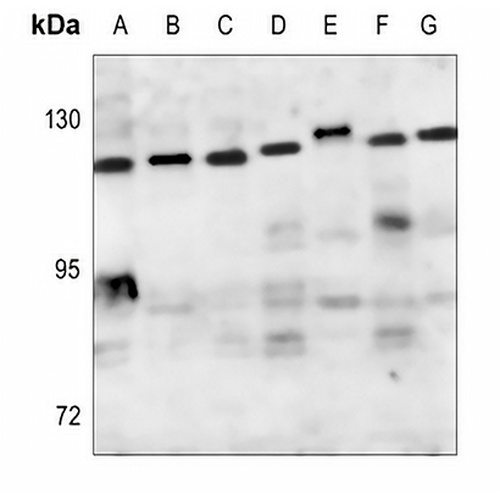 ZHX2 Rabbit Polyclonal Antibody