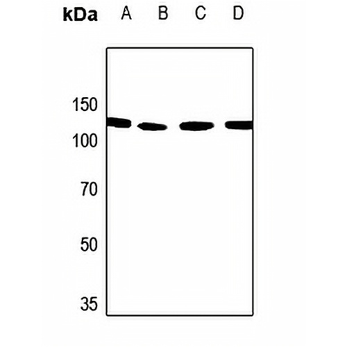 PALLD Rabbit Polyclonal Antibody