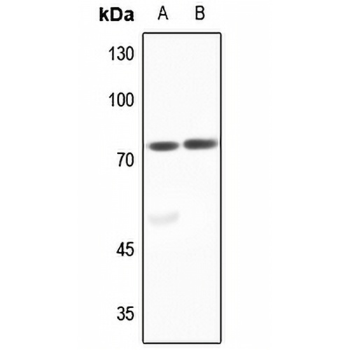 ACSL6 Rabbit Polyclonal Antibody