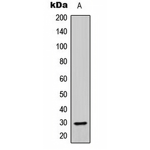 ABHD14A Rabbit Polyclonal Antibody