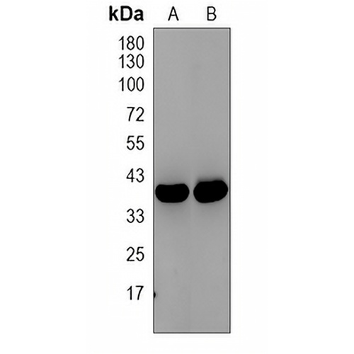 ANKRD1 Rabbit Polyclonal Antibody