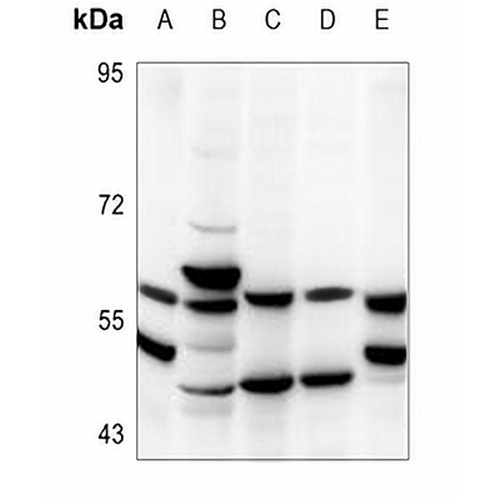 TBX22 Rabbit Polyclonal Antibody