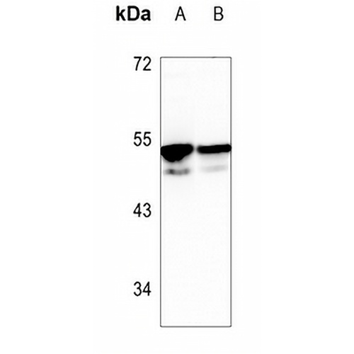 CDKL3 Rabbit Polyclonal Antibody
