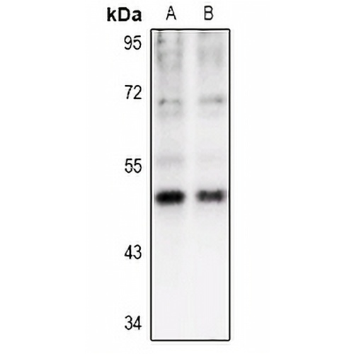 CK1 gamma 1 Rabbit Polyclonal Antibody
