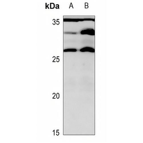 MRPL16 Rabbit Polyclonal Antibody