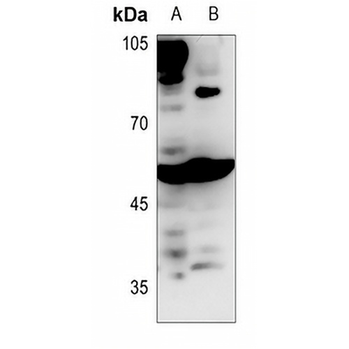 BAIAP2L1 Rabbit Polyclonal Antibody