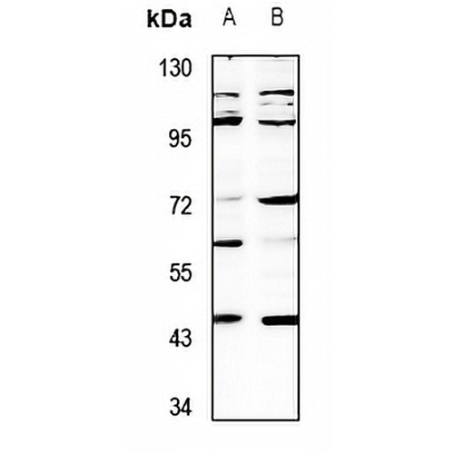 SH3GLB2 Rabbit Polyclonal Antibody