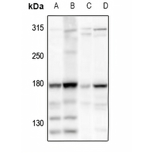HECW2 Rabbit Polyclonal Antibody