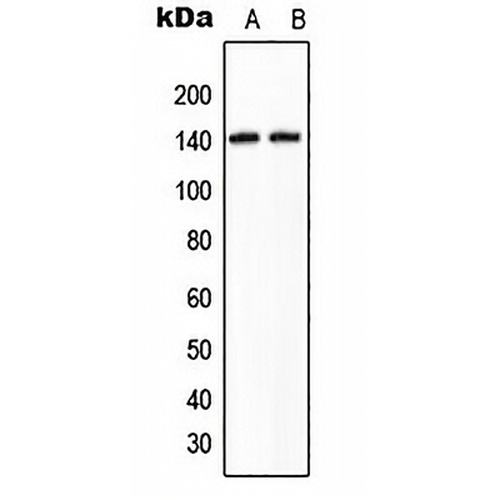 KIAA1967 Rabbit Polyclonal Antibody