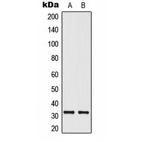 ELOVL1 Rabbit Polyclonal Antibody