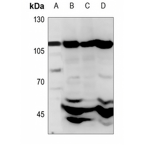 CARD14 Rabbit Polyclonal Antibody