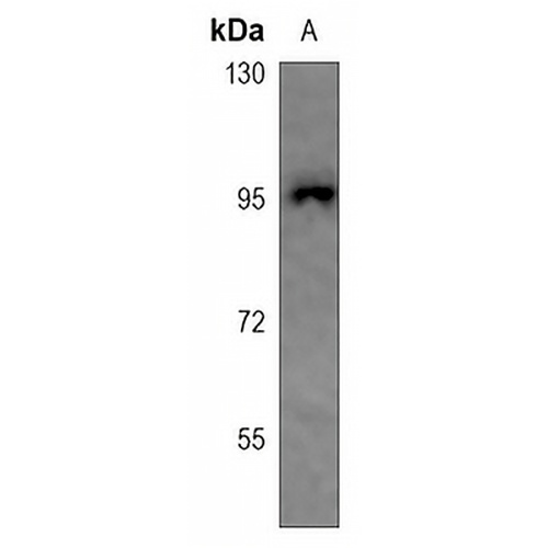 CHSY2 Rabbit Polyclonal Antibody