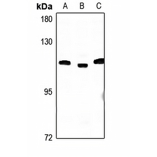 CCP2 Rabbit Polyclonal Antibody