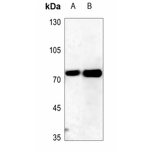 ITPKC Rabbit Polyclonal Antibody