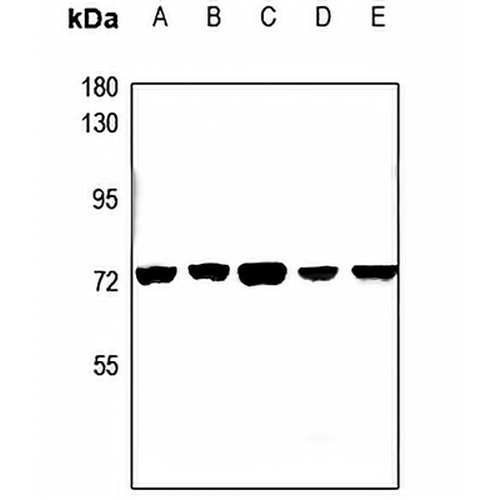 CEP70 Rabbit Polyclonal Antibody