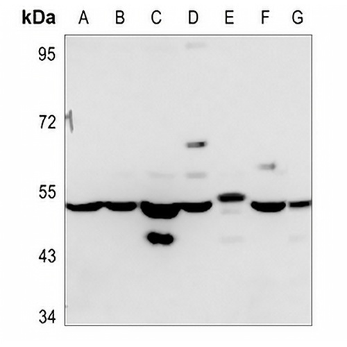 ADPGK Rabbit Polyclonal Antibody