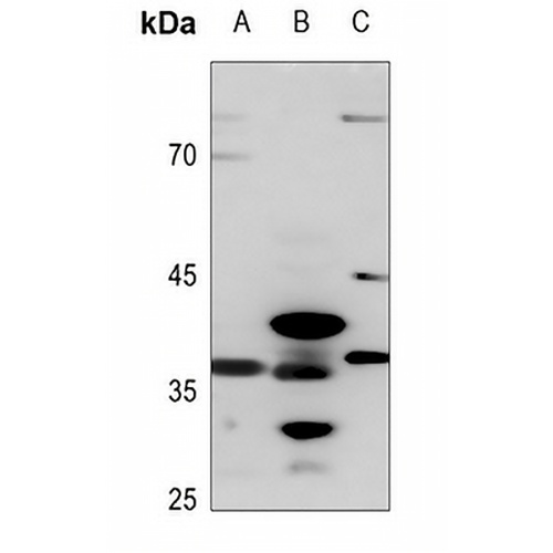AKR1CL2 Rabbit Polyclonal Antibody