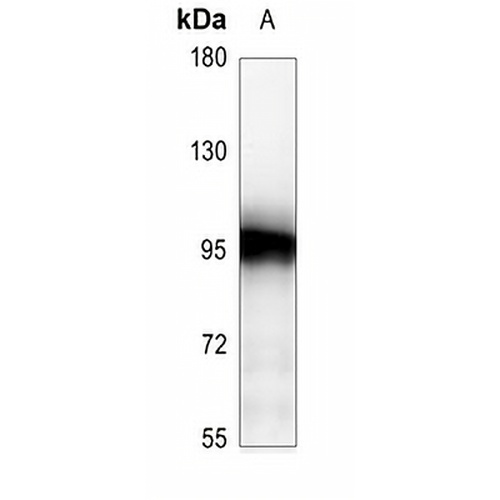 ATRIP Rabbit Polyclonal Antibody