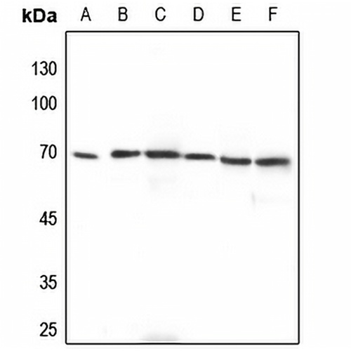 ADCK2 Rabbit Polyclonal Antibody