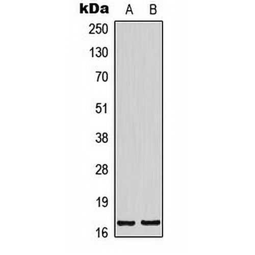 BTF3L4 Rabbit Polyclonal Antibody