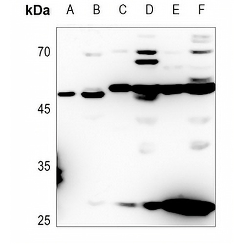 ACOT4 Rabbit Polyclonal Antibody