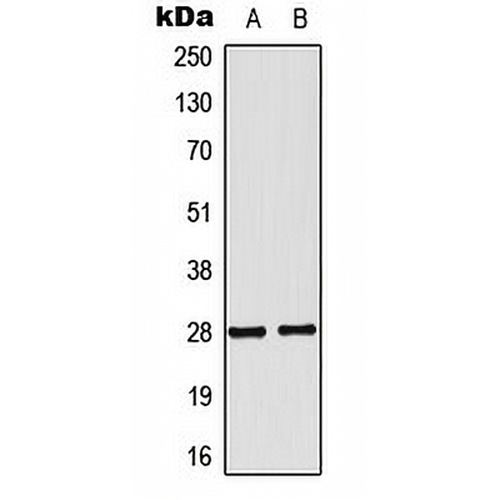 NKX2-6 Rabbit Polyclonal Antibody