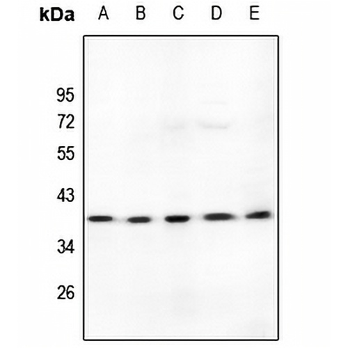LDLRAD3 Rabbit Polyclonal Antibody