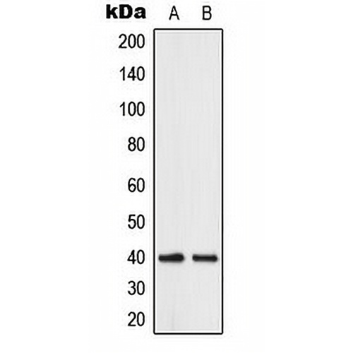 ABHD12B Rabbit Polyclonal Antibody