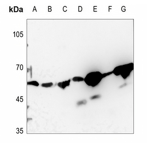 DQX1 Rabbit Polyclonal Antibody