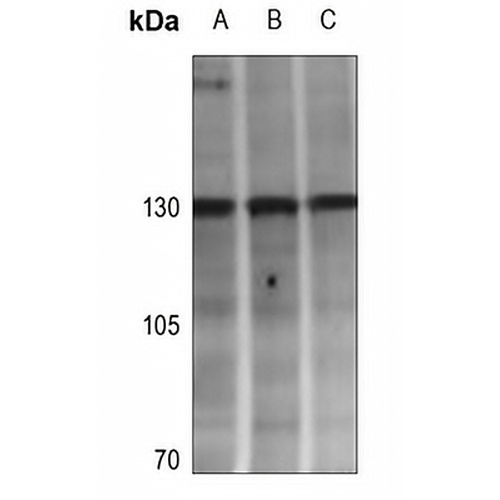 Adenylate Cyclase 4 Rabbit Polyclonal Antibody