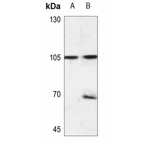 EEF2K (Phospho-S366) Rabbit Polyclonal Antibody