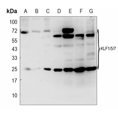 KLF1/5/7 Rabbit Polyclonal Antibody