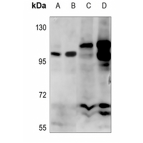 Alpha-adducin (Phospho-S726/713) Rabbit Polyclonal Antibody