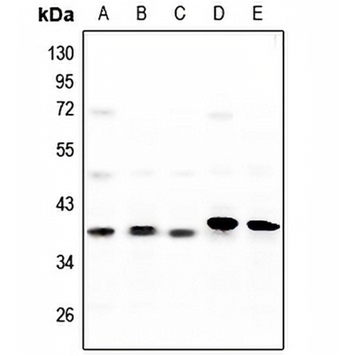 CK1 alpha Rabbit Polyclonal Antibody