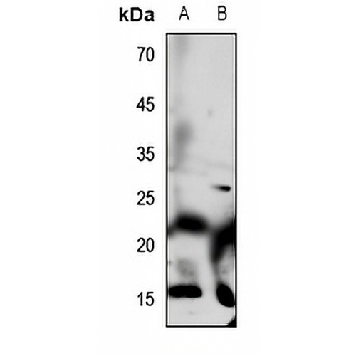 Defensin alpha 1 Rabbit Polyclonal Antibody