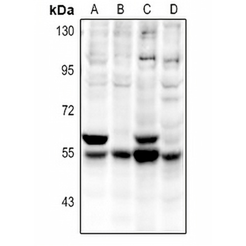 CaMK2 alpha/delta Rabbit Polyclonal Antibody