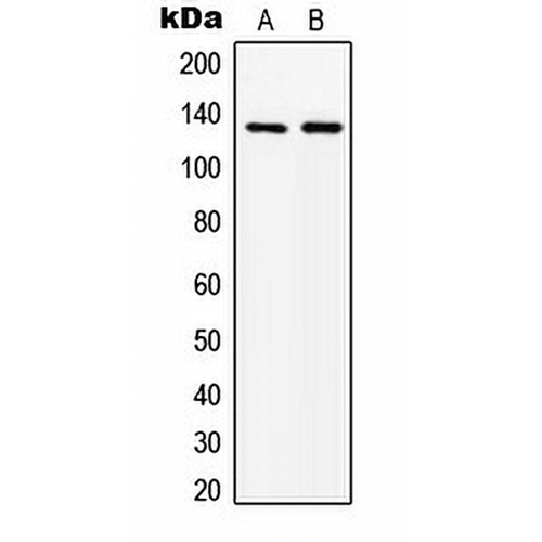 ABL1 Rabbit Polyclonal Antibody