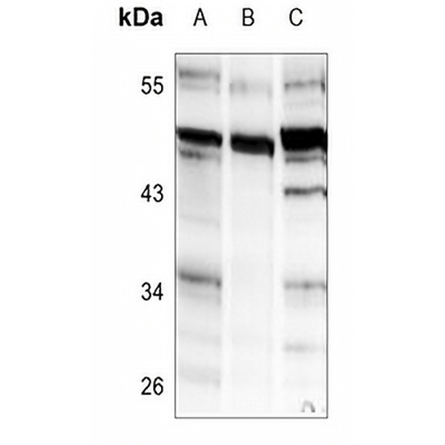 AChE Q Rabbit Polyclonal Antibody