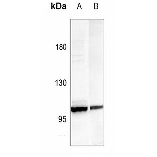 ADAM19 Rabbit Polyclonal Antibody