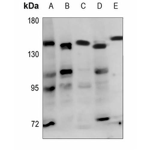 ADAMTS18 Rabbit Polyclonal Antibody