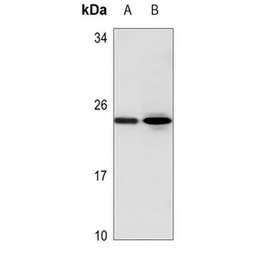 AID Rabbit Polyclonal Antibody