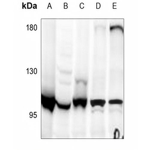 Apolipoprotein B Receptor Rabbit Polyclonal Antibody