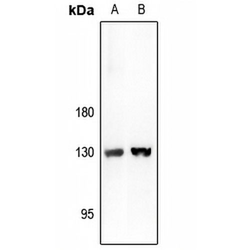 ARHGAP20 Rabbit Polyclonal Antibody