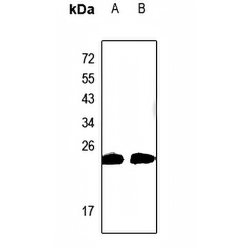 CABP2 Rabbit Polyclonal Antibody