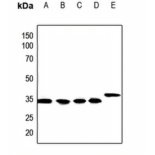 Calponin 1 Rabbit Polyclonal Antibody
