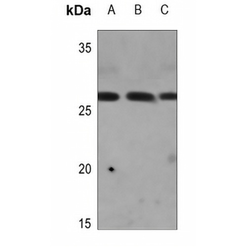 CAPNS2 Rabbit Polyclonal Antibody